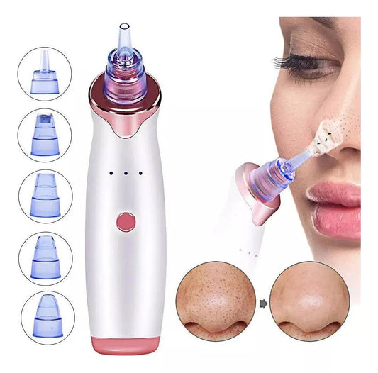 Aspirador Facial para Limpieza de Acne y Puntos Negros - Super Carrito